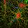 Hippocampal neurons