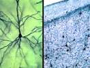 Cerebral pyramidal neurons (Golgi stain)