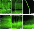 Expression of XFP in the Hippocampus and Cerebral Cortex