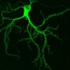 GFP-tagged protein in a hippocampal neuron