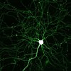 Hippocampal neuron expressing monomeric Green Fluorescent Protein