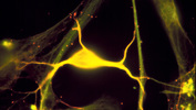 Hippocampal neuron stained for spectrin (red) and tubulin (green)