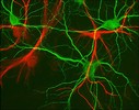 Hippocampal neurons (green) and glial cells (red)