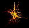 Laser confocal images of neurons in hippocampal slice gene gun transfected with DCX DsRed and μ1A GFP