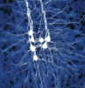 Micrograph of neurons in rat neocortex