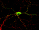 Neuron expressing GFP-CaMKII (green) with immunolabeling of all excitatory synapses (red, PSD-95)