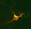 Neuron transfected with doublecortin (DCX) DsRed and mannose phosphate receptor (MPR) GFP-1