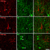 PHF-tau-ir neurons - PV-ir axon terminals