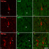 PHF-tau-ir neurons - chandelier cell axon terminals
