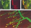 Vital Staining of Adult Neuromuscular Junctions in a thy1-YFP Transgenic Mouse