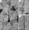 Dendritic spine density on cerebral cortical pyramidal neurons