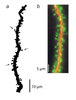 Dendritic Spines and Microtubules