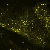 Mouse amygdala neurons activated by fear stimulus