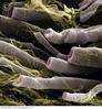 Myelinated nerve fibres