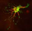 Neuron transfected with doublecortin (DCX) DsRed and mannose phosphate receptor (MPR) GFP 2