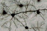 Pyramidal neurons in mouse cerebral cortex (Golgi stain)